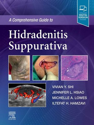 cover image of A Comprehensive Guide to Hidradenitis Suppurativa--EBook